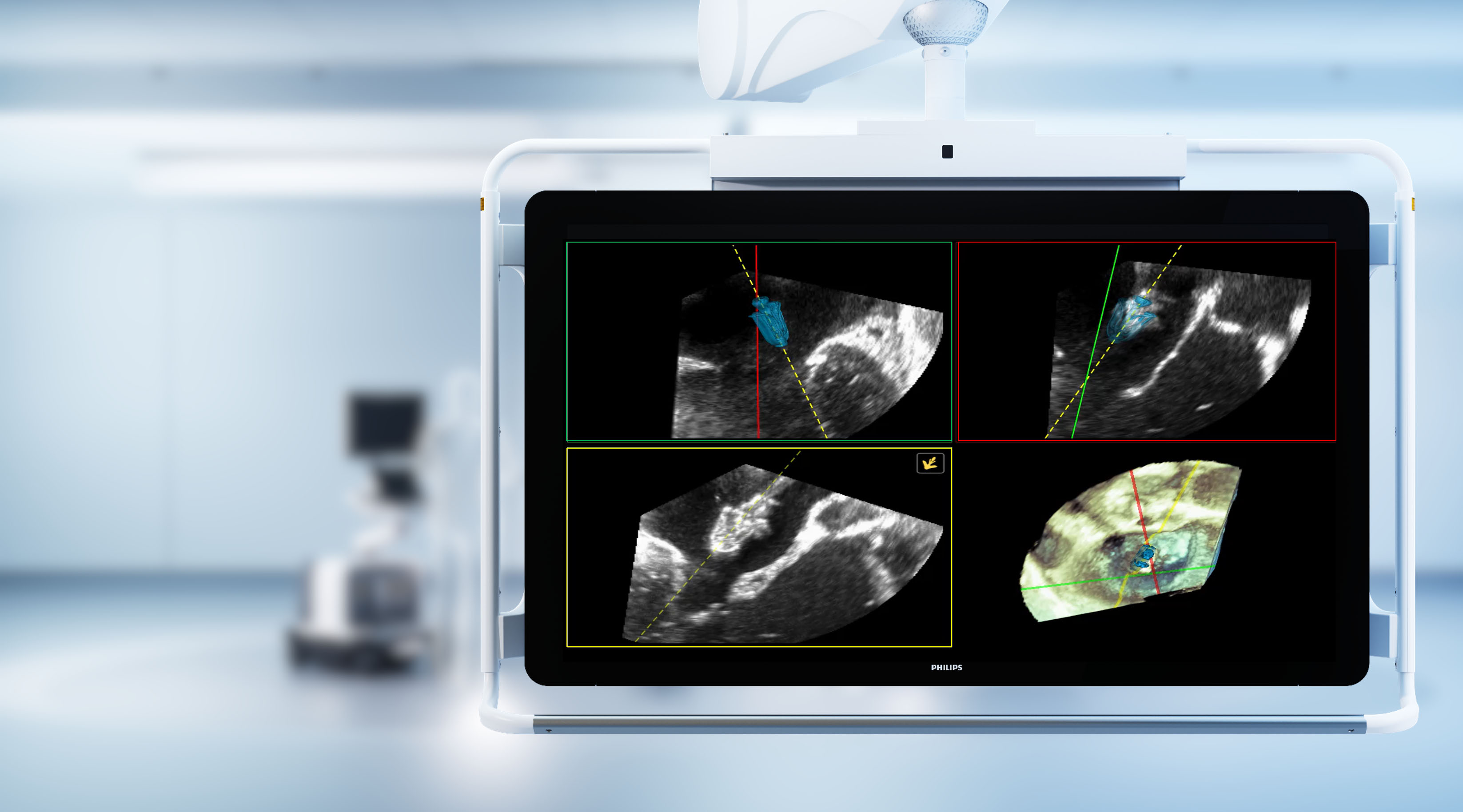 Philips DeviceGuide gets FDA Clearance | Philips
