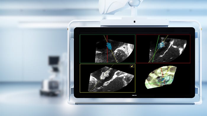 DeviceGuide with EchoNavigator 5 -  