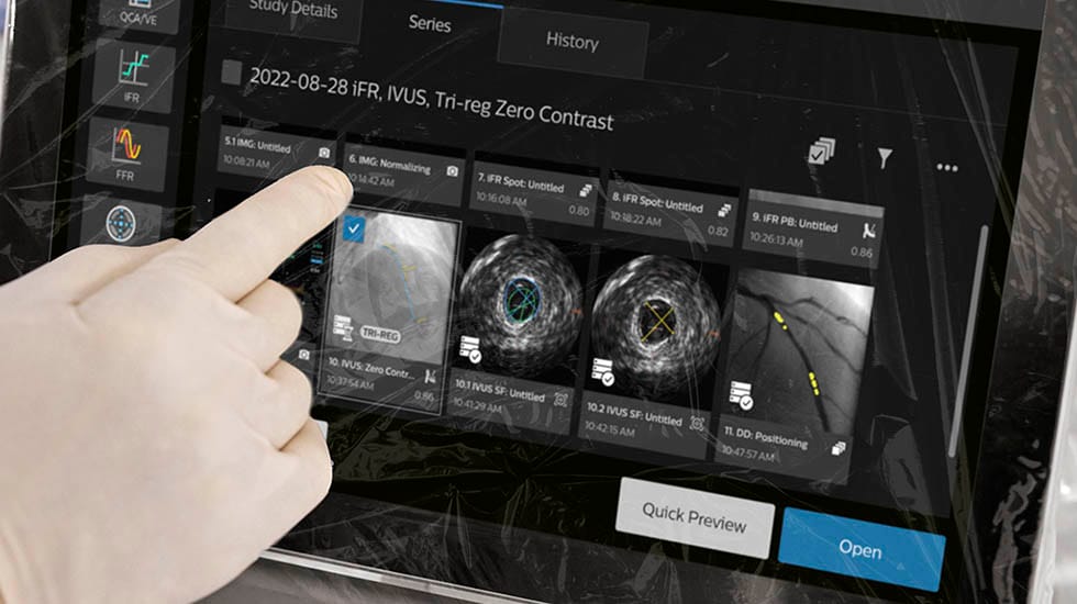 Philips IntraSight Plus