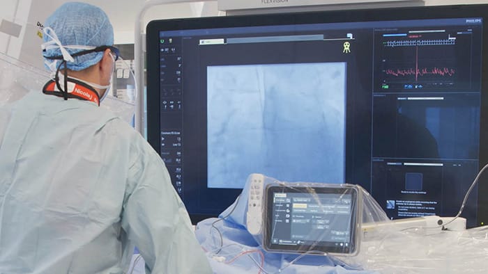 Philips Azurion with SmartIQ -  