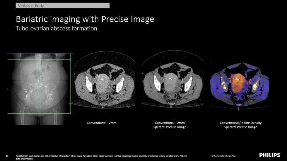 Feature article clinical bariatric image