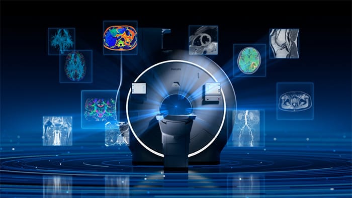 Titanion MR, a new class of ultra-high-gradient 3.0T MRI -  