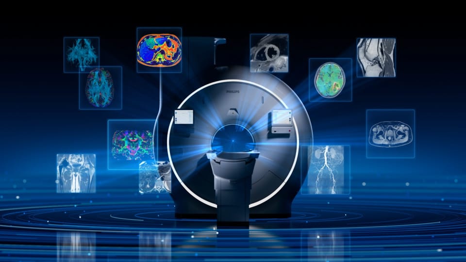 Titanion MR, a new class of ultra-high-gradient 3.0T MRI
