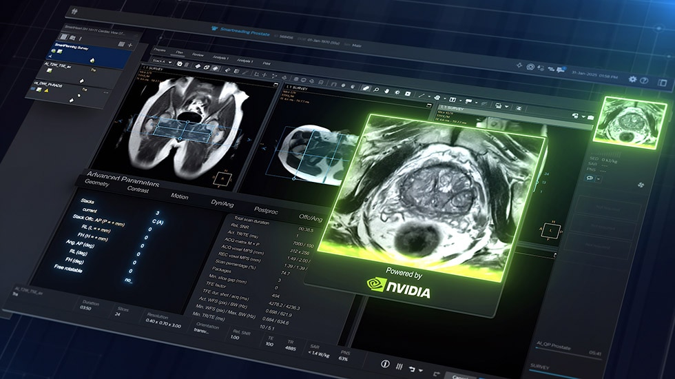 Philips x NVIDIA: predictive MRI image generation