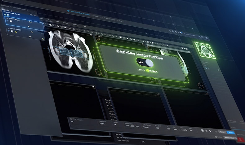 Philips x NVIDIA: predictive MRI image generation