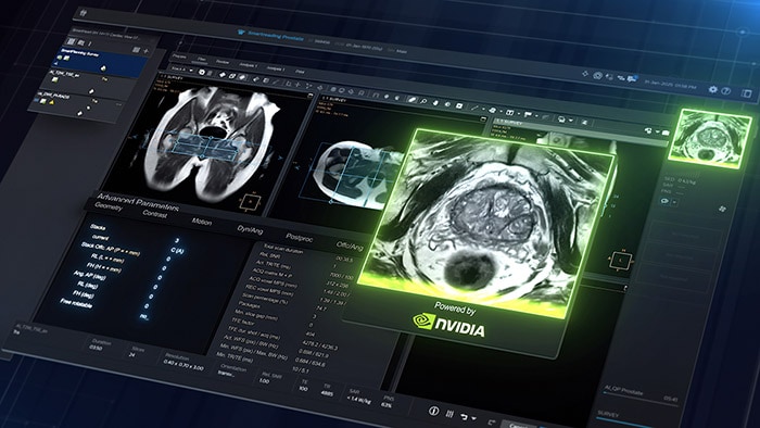 Seeing before scanning: Philips’ predictive preview on the path to autonomous MRI