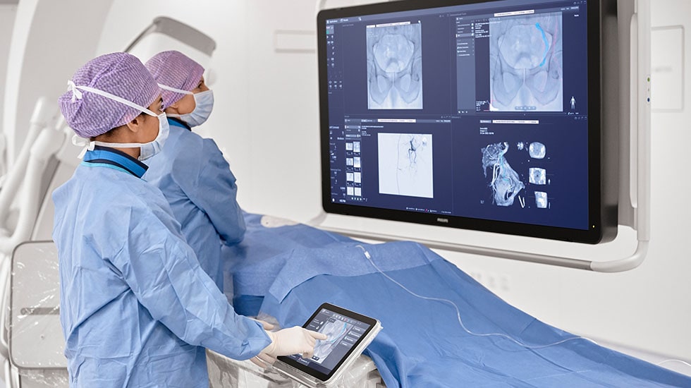 Interventional oncology procedure on Philips Azurion