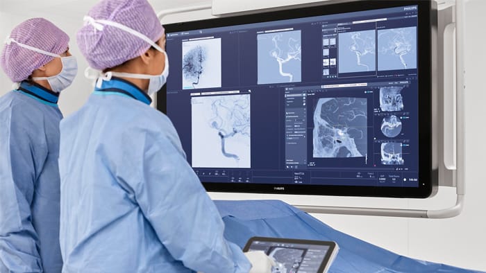 Methodist Hospitals selects Philips to advance neurovascular ...