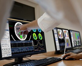 spotlight IntelliSpace Portal Advancing care Neurology