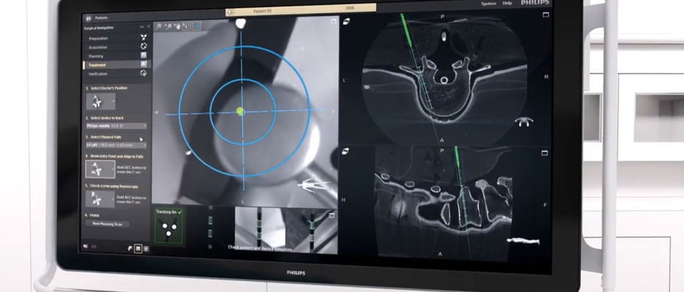 augmented reality surgical navigation video