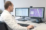 Prof. Dr. Thomas Tousseyn, anatoom-patholoog UZ Leuven, onderzoekt weefsel op kenmerken van kanke