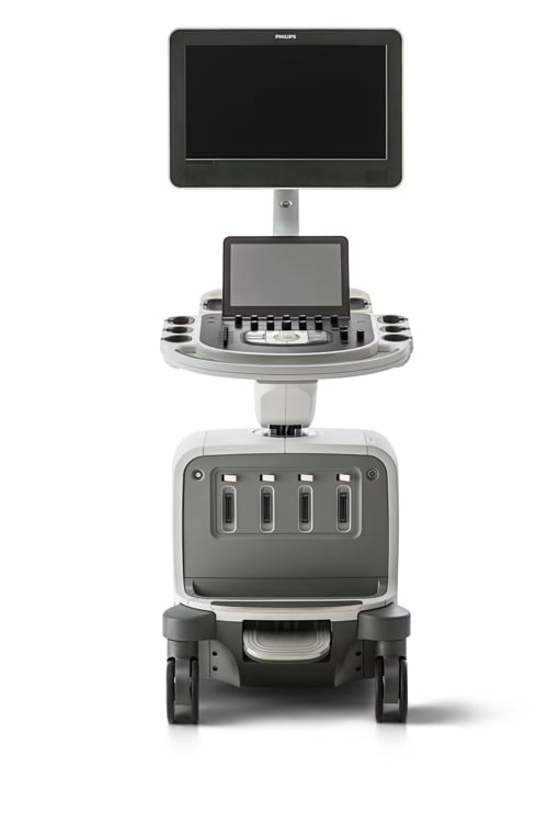 Diversified Auto Sales >> Philips launches new EPIQ premium ultrasound system with ... Diversified Auto Sales >> Philips launches new EPIQ premium ultrasound system with ...