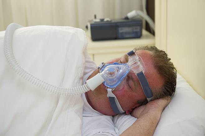 Obstructive Sleep Apnea (OSA)