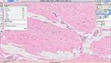 Digital scan of glass tissue sample