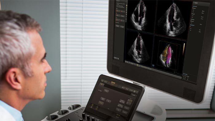 Philips HeartModel A.I. – Taking the complexity out of cardiac ultrasounds