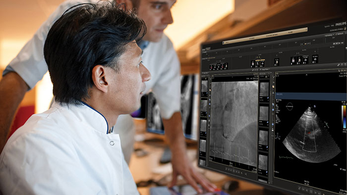 Philips debuts innovations in ultrasound and enterprise informatics to advance cardiac care at ESC 2019